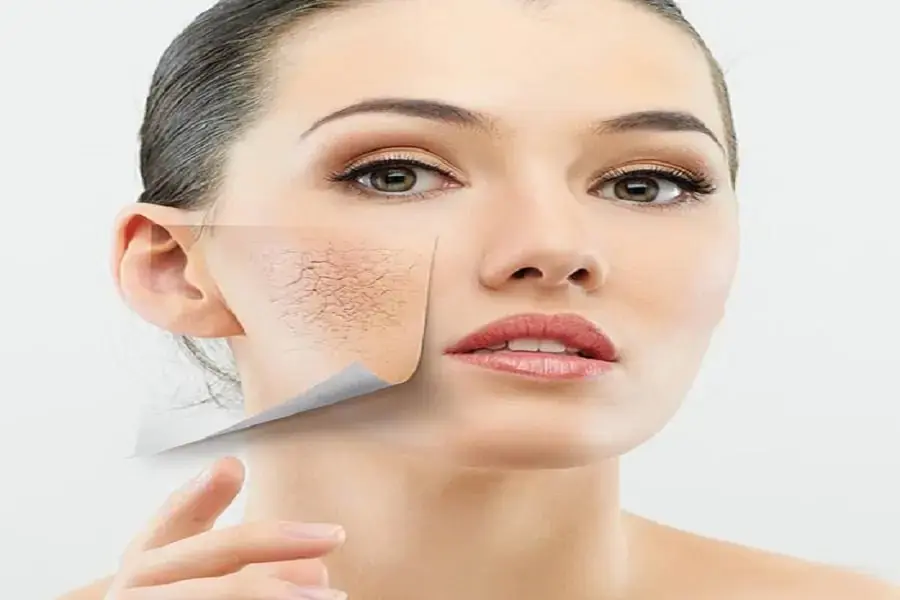 Mở máy lạnh và quạt bạn sẽ không cần hạ nhiệt độ quá thấp, tránh được tình trạng khô da (Hình ảnh: Fresh-beautiful-style)