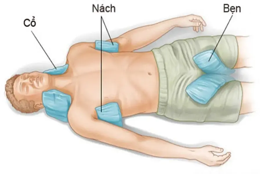Chườm lạnh vào những nơi có động mạch lớn giúp xử lý sốc nhiệt hiệu quả (Hình ảnh: vienyhocungdung)