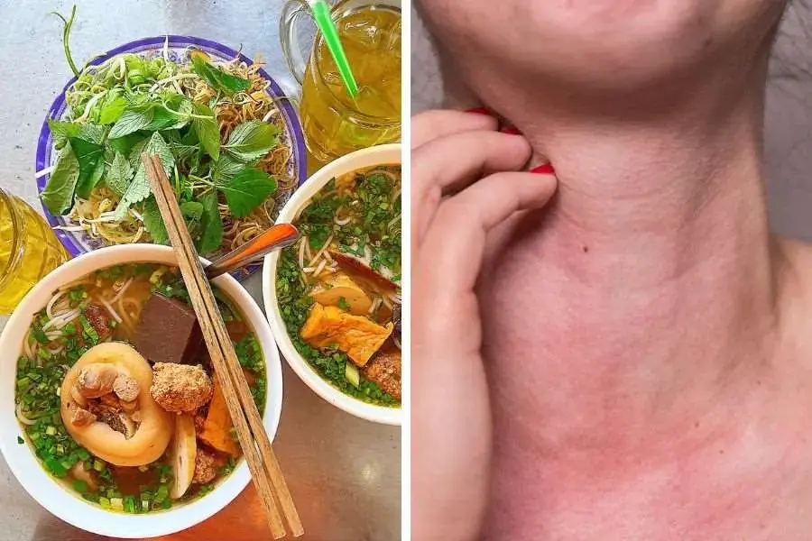 Những người bị dị ứng với thủy hải sản tôm, cua,... thì không nên ăn bún riêu.