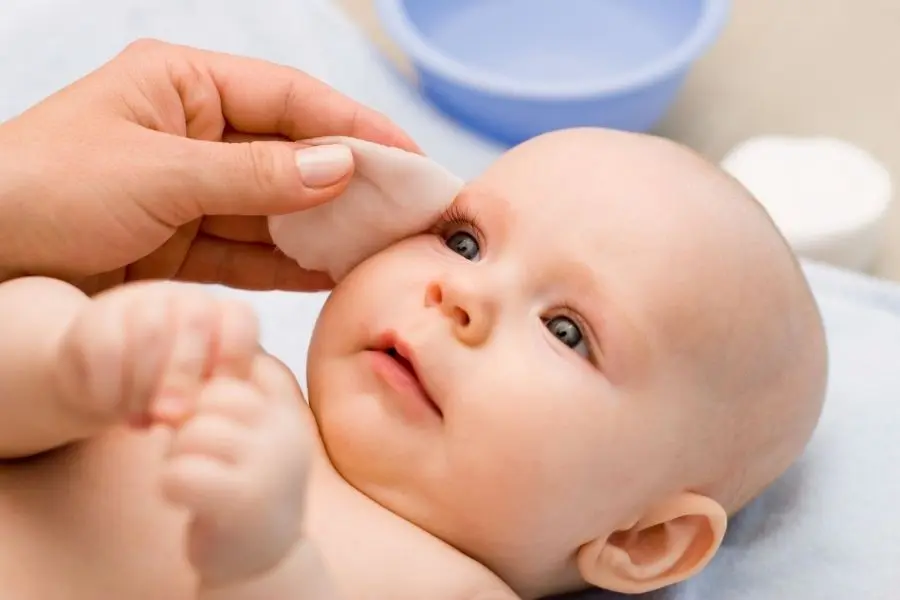 Nên làm gi khi trẻ bị mụn sữa