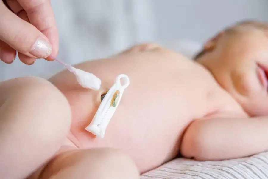 Cần phải cẩn thận khi chăm sóc rốn trẻ sơ sinh (5)