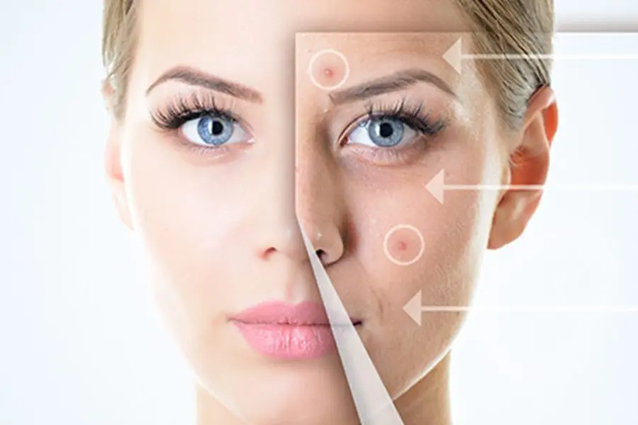 Chọn sản phẩm trị mụn, thâm phù hợp.
