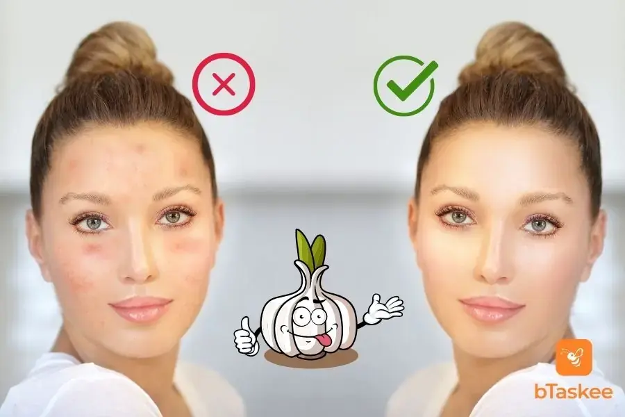 Củ tỏi giàu allicin, vitamin và khoáng chất có tác dụng trị mụn