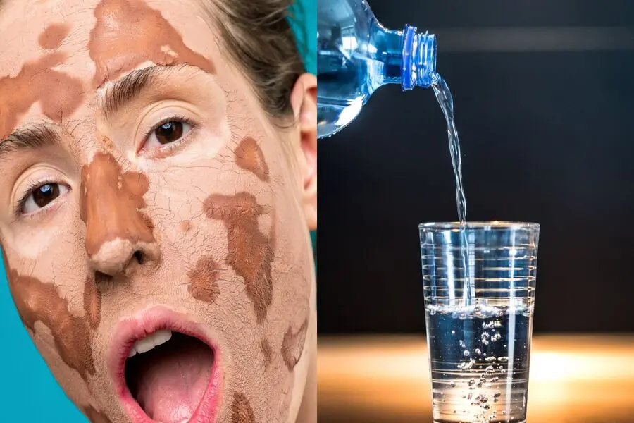 Sử dụng những sản phẩm dưỡng ẩm với người có làn da khô.