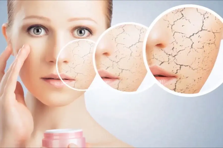 Nên chọn kem dưỡng da phù hợp với da khô.