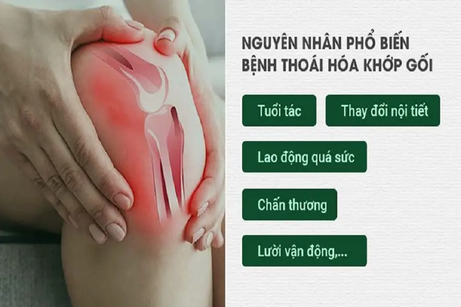 Có nhiều nguyên nhân dẫn đến bệnh thoái hóa khớp, gây đau nhức dữ dội.