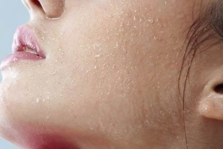 Để chăm sóc da khô một cách có hiệu quả nhất, cần lưu ý một số vấn đề