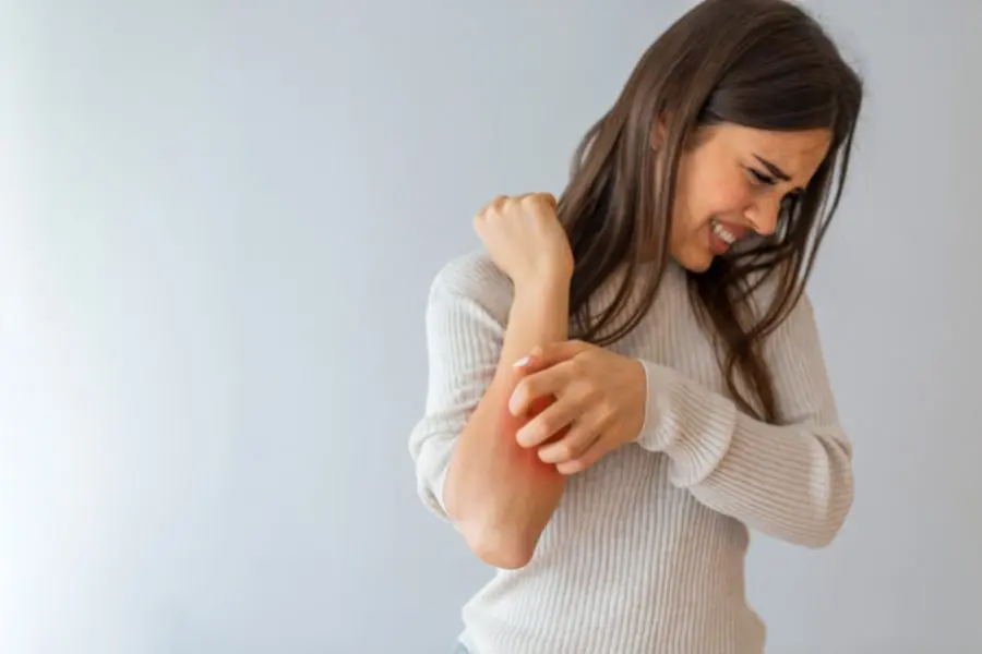 Da nhạy cảm là làn da thường bị mẩn ngứa, châm chích và rát đỏ.