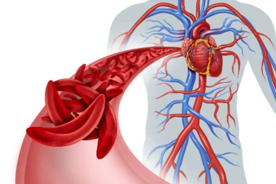 Dứa tốt cho hệ tuần hoàn và tim mạch