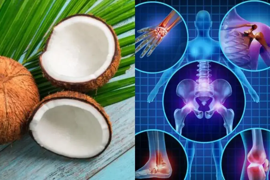 Cùi dừa có tác dụng tuyệt vời đối với hệ xương khớp trong cơ thể.