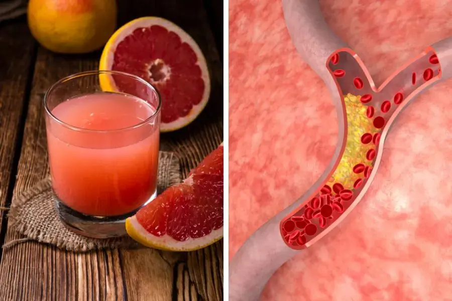 Tác dụng của nước ép bưởi: Có nhiều chất chống oxy hóa, ngăn chặn hình thành cholesterol xấu