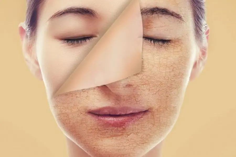 Da khô không phải do thiếu nước.