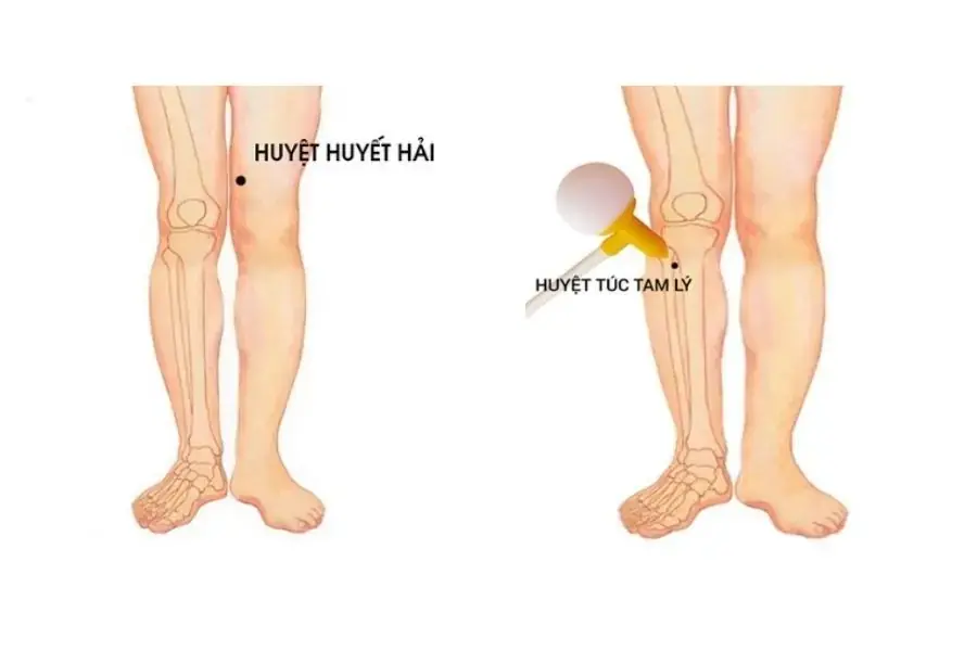 Huyệt Huyết hải và Túc tam lý ở đầu gối ( nguồn: Internet)