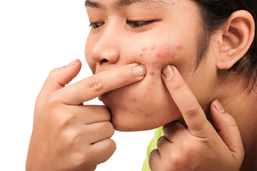 Dùng lá lốt trị mụn hiệu quả