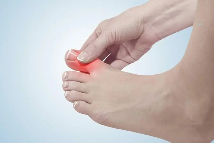 Những người mắc bệnh gout không nên ăn đậu phụ.