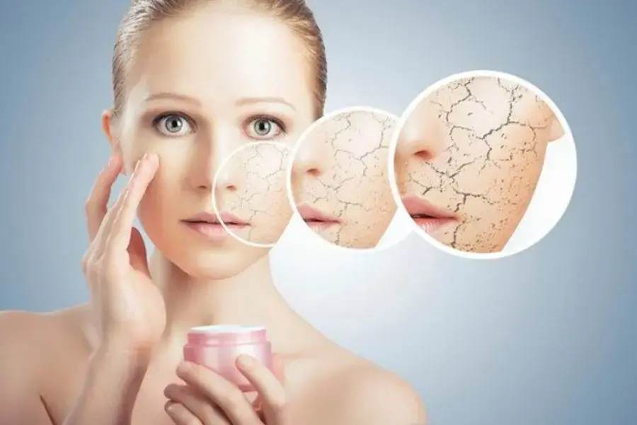 Da sẽ bị khô, nứt nẻ nếu quá lạm dụng chế độ dry của điều hòa.