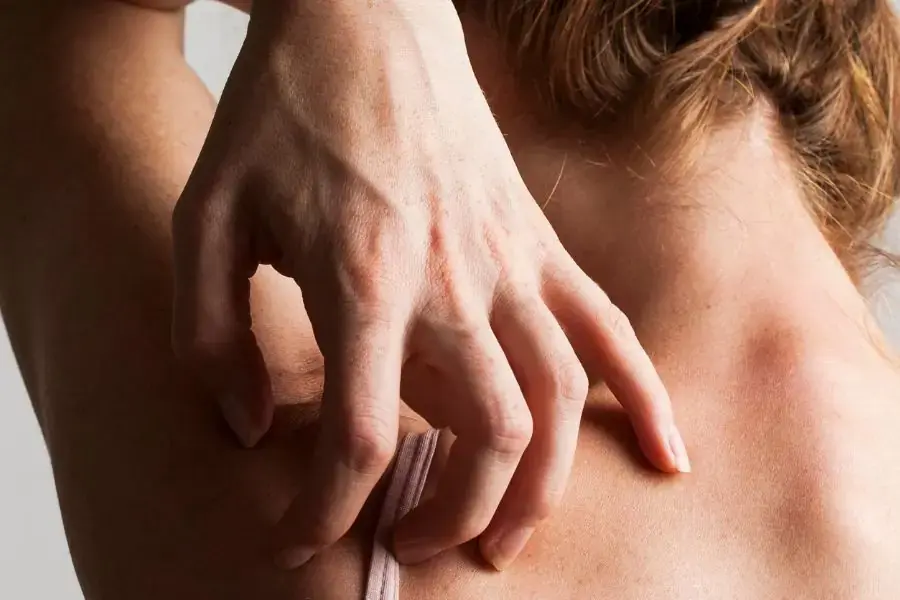 Kiểm tra chất lượng đệm khi xuất hiện tình trạng da bị mẩn đỏ, ngứa ngáy