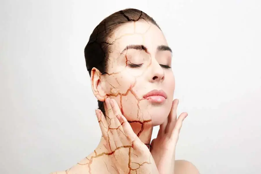 Da khô và thiếu sức sống là tác hại của máy lạnh với da (nguồn: affderm.com)