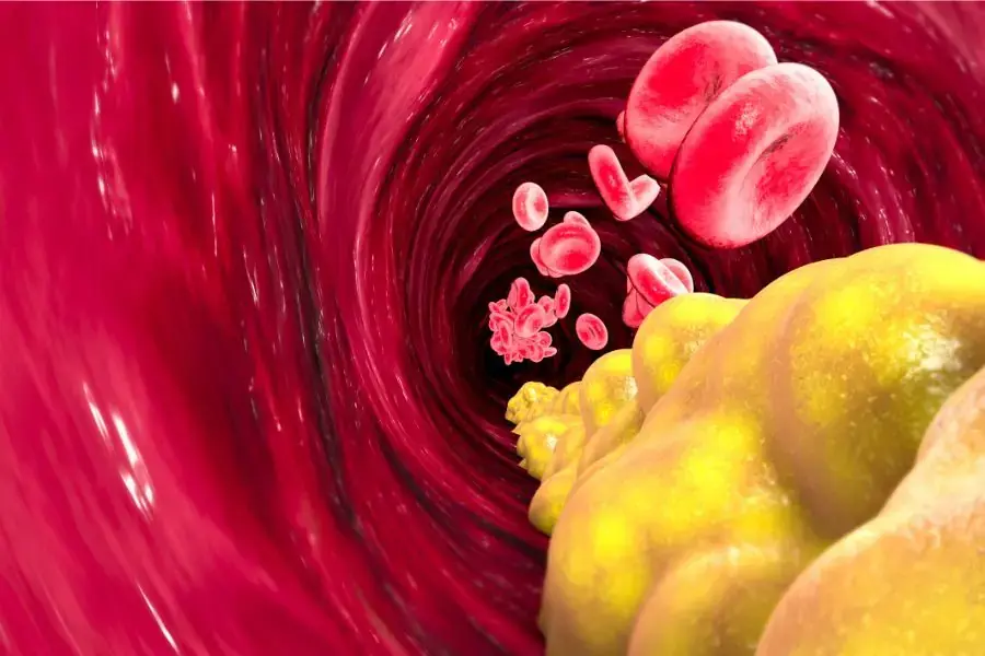Hạn chế dung nạp Cholesterol