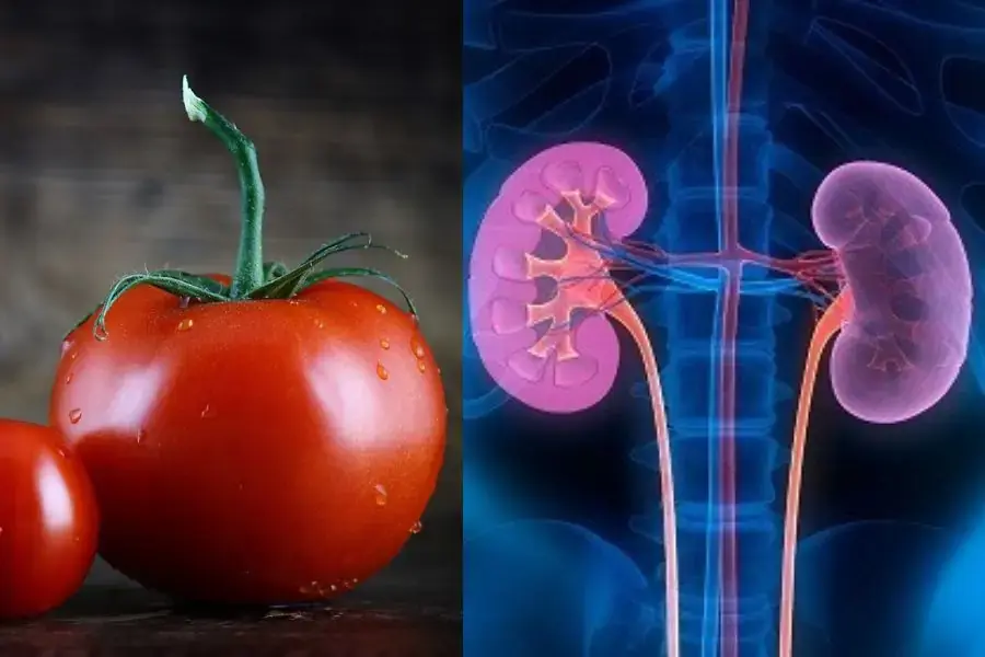 Cà chua có thể gây ra sỏi thận.