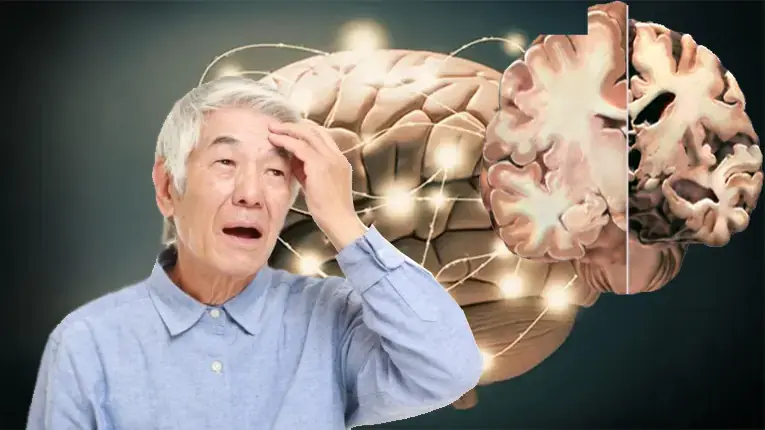 Bệnh Alzheimer thường hay xuất hiện ở tuổi già