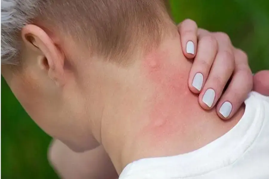 Khi cơ thể xuất hiện nhiều triệu chứng khác lạ nên đến cơ sở ý tế gần nhất để chữa trị.