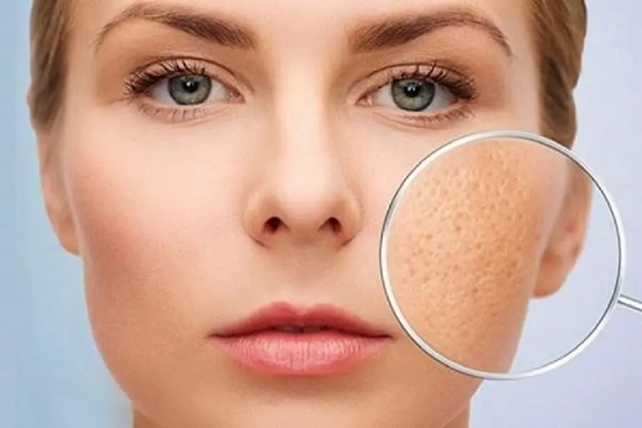 Chăm rửa mặt với nước vo gạo sẽ giúp lỗ chân lông được thu nhỏ đáng kể.