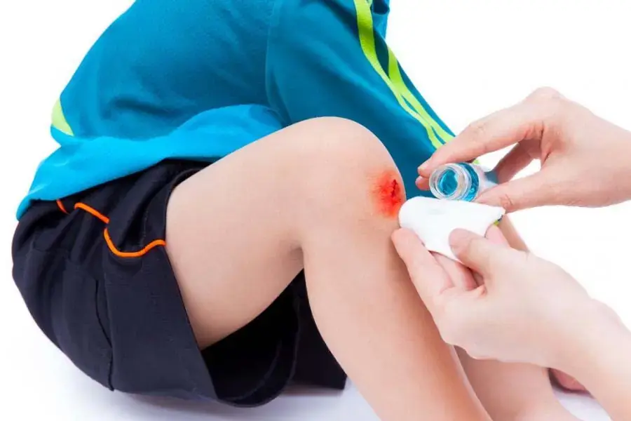 Rửa sạch, sát trùng vết thương cho trẻ (4)