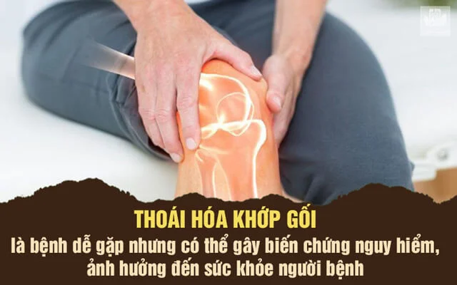 Thoái Hóa Khớp Gối Là Gì? Cách Điều Trị Hiệu Quả