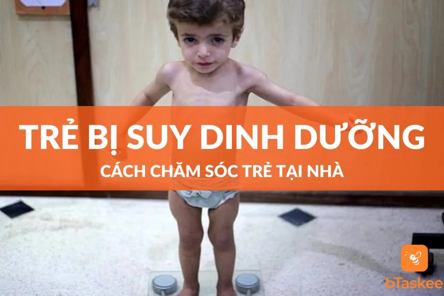 Cách Chăm Sóc Trẻ Bị Suy Dinh Dưỡng Khoa Học Nhất