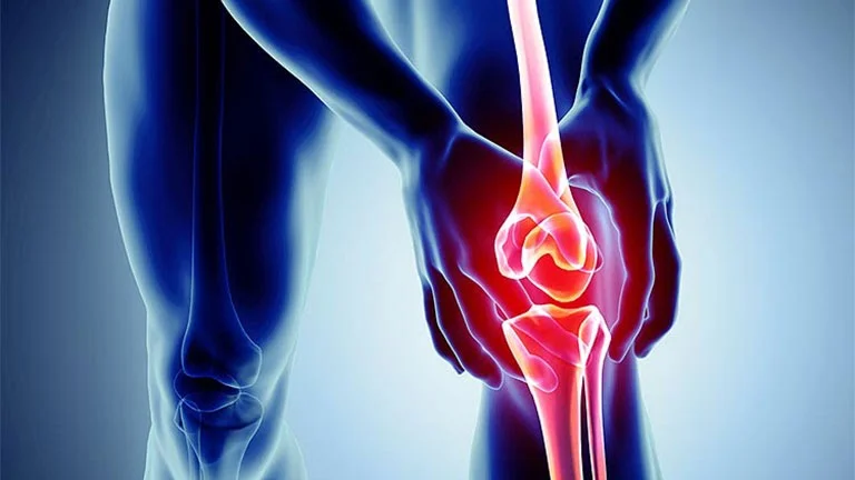 Thoái Hóa Khớp Là Gì? Nguyên Nhân Và Cách Phòng Ngừa