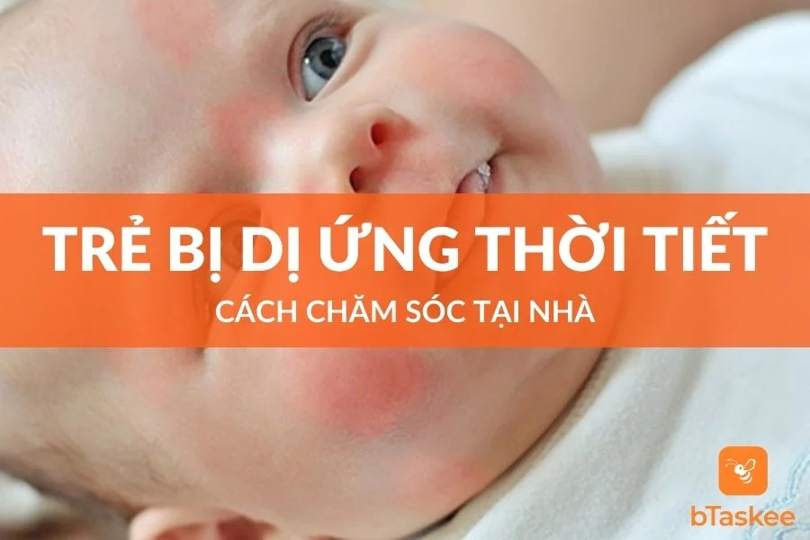 Cách Chăm Sóc Trẻ Bị Dị Ứng Thời Tiết Đúng Cách