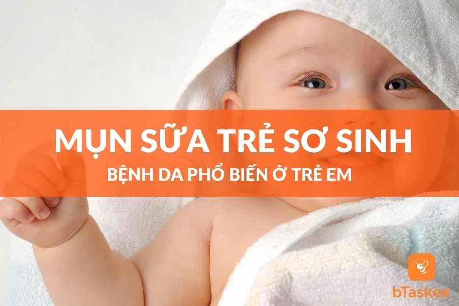 Xử Trí Mụn Sữa Ở Trẻ Sơ Sinh Đúng Cách Và Điều Nên Làm