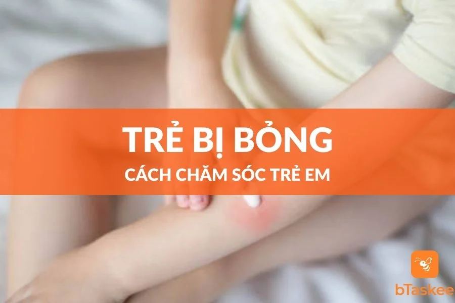 Hướng Dẫn Sơ Cứu Trẻ Bị Bỏng Nước Sôi Đúng Cách