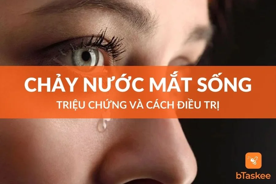 Chảy Nước Mắt Sống Là Gì? Triệu Chứng Và Cách Điều Trị